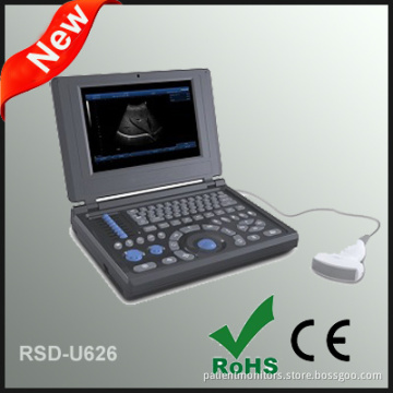 Laptop Full Digital Ultrasonic Diagnostic System